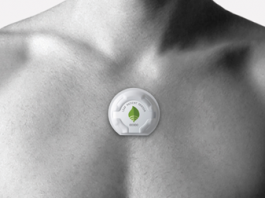 Interview with Barrett Larson, Leaf Healthcare, about Pressure Ulcer Prevention