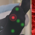 Wearables for Diabetics