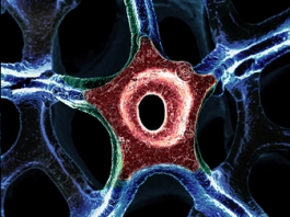 Graphene – The Magic Ingredient for Advanced Wearables