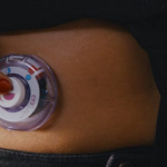 enFuse Allows Patients Self-Administer Biologics with Ease enfuse