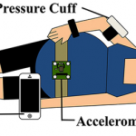Smartphone App to Test Preeclampsia at Home preeclampsia