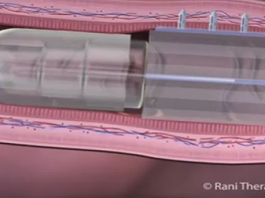 How Smart Pills Could Revolutionize Healthcare smart pill