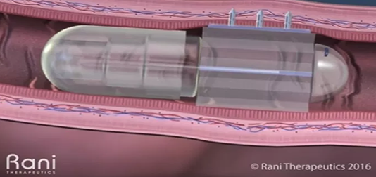 How Smart Pills Could Revolutionize Healthcare smart pill