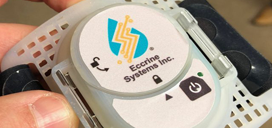 This Wearable Device Wants You to Sweat So that It Can Monitor Your Health sweatronics