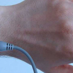 Financial Incentives, Wearable Tracker Increase Physical Activity in Heart Patients Financial incentives in ischemic heart disease patients