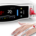 Study Investigates the Utility of Masimo PVi Monitoring During Colorectal Surgery Masimo pvi monitoring