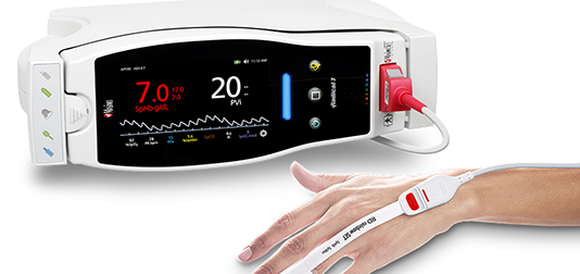Study Investigates the Utility of Masimo PVi Monitoring During Colorectal Surgery Masimo pvi monitoring