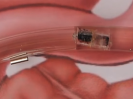 Smart Pills Will Change the Way We Take Medications