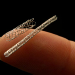 Smart-stent-2