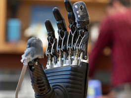 Electronic Skin for Prosthetic Hands Lets Amputees Feel Pain e-dermis