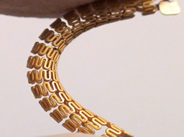 This “Smart Stent” Can Monitor Blood Flow and Detect Narrowing of Artery smart stent