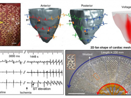 Scientists Develop Flexible, Conductive Mesh for Implantable and Wearable Bioelectronics Flexible, conductive mesh