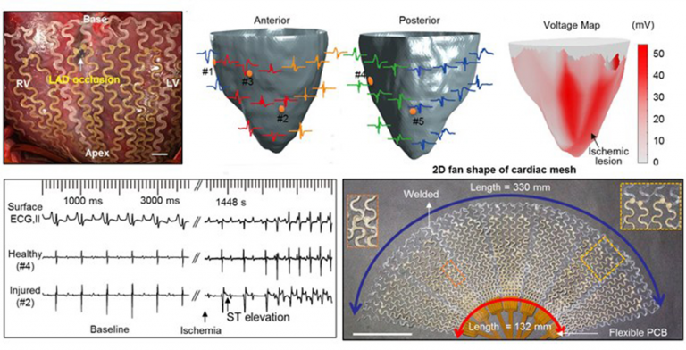 Flexible, conductive mesh