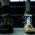 Smart Prosthetic Ankle Adjusts to Uneven Ground, Stairs Smart prosthetic ankle