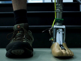 Smart Prosthetic Ankle Adjusts to Uneven Ground, Stairs Smart prosthetic ankle