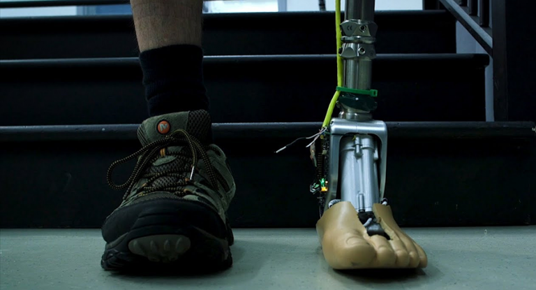 Smart prosthetic ankle