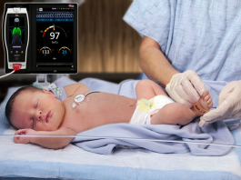 Masimo’s Rainbow Acoustic Monitoring RAS-45 Breathing Sensor for Babies Gets FDA Clearance Masimo RAS 45