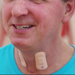 Northwestern Researchers Develop Groundbreaking Wearable that Could Be a Game Changer in Stroke Rehab Sensor for stroke