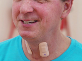 Northwestern Researchers Develop Groundbreaking Wearable that Could Be a Game Changer in Stroke Rehab Sensor for stroke