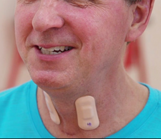 Northwestern Researchers Develop Groundbreaking Wearable that Could Be a Game Changer in Stroke Rehab Sensor for stroke