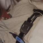 Wearables for Chronic Diseases and Mobility Challenges Chronic diseases