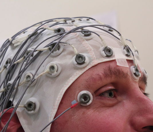 Epilepsy Foundation Awards $3 Million Grant to Scientists for its Seizure Gauge Initiative Epilepsy foundation my seizure gauge