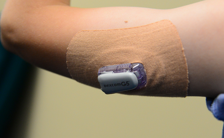 Glucose powered implants