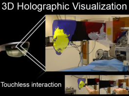 Doctors Use HoloLens to Investigate Heart Scars in High Resolution Before Surgery HoloLens for Surgery