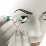 NovioSense Announces Phase 2 Positive Clinical Trial Results of Tear Glucose Measurement Technology NovioSense glucose sensor