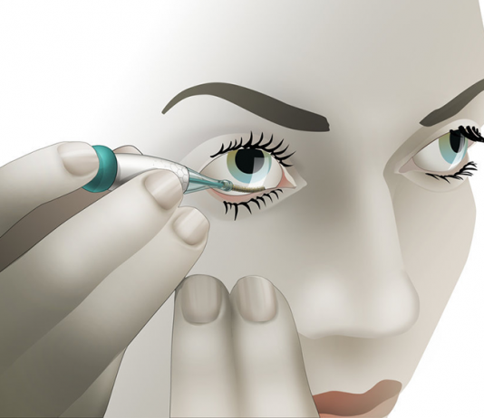 NovioSense Announces Phase 2 Positive Clinical Trial Results of Tear Glucose Measurement Technology NovioSense glucose sensor