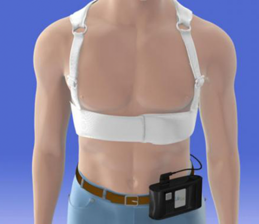Wearable Cardioverter-Defibrillator Does Not Prevent Sudden Death After Myocardial Infarctions Wearable Cardioverter-Defibrillator