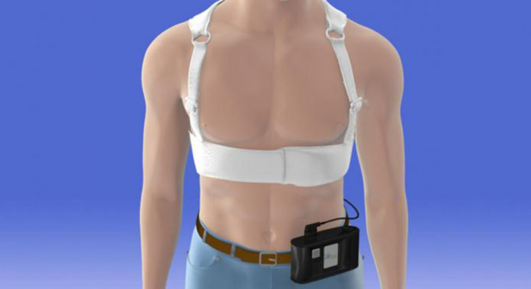 Wearable Cardioverter-Defibrillator