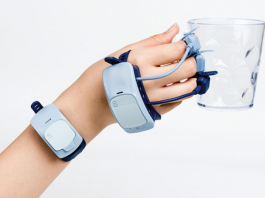MANOVIVO: Wearable Smart Glove Offering Custom Support for People with Rheumatoid Arthritis Manovivo rheumatoid arthritis