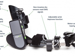 Myomo Will Deliver its MyoPro for the First Time on Adolescent Users Myomo MyoPro adolescents