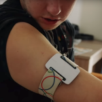 Nightwatch – Wearable Night Time Seizure Detection Device Developed by Dutch Scientists Nightwatch seizure detection