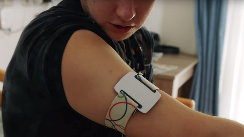 New Smart Watch Alerts Caregivers To Potential Seizures In Epilepsy Patients