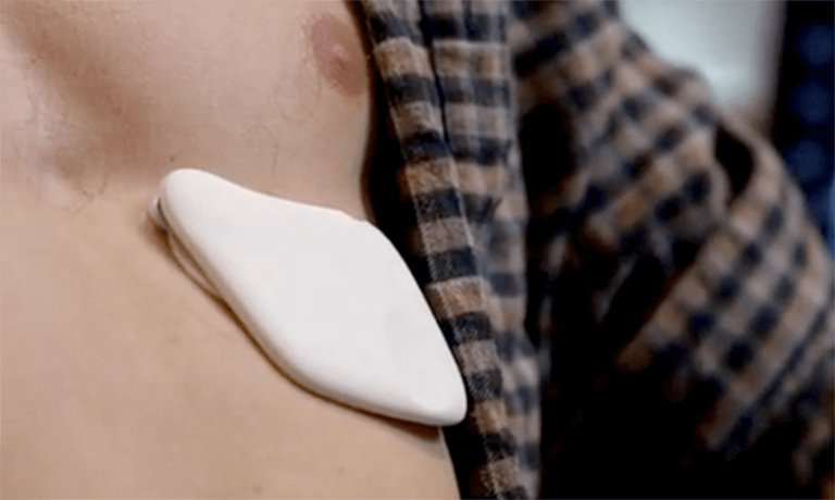 Stress monitoring patches