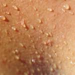 Wearable Sensor Uses Sweat to Check Blood Alcohol Content Sweat blood alcohol