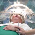 Abbott, Medtronic Driving Deep Brain Stimulation Innovation for Parkinson’s Disease DBS for Parkinsons