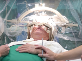 Abbott, Medtronic Driving Deep Brain Stimulation Innovation for Parkinson’s Disease DBS for Parkinsons