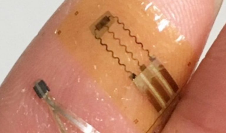 Parkinsons wearable sensors