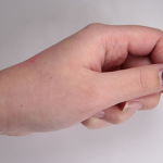 World’s Smallest Wearable Device Warns of UV Exposure and Helps to Optimize Phototherapy Worlds smallest UV tracker