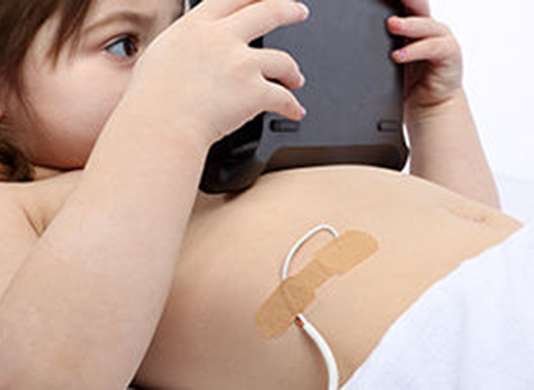 3M Exhibited Wearable Smart Medical Adhesives at CES 2019 3m smart adhesives