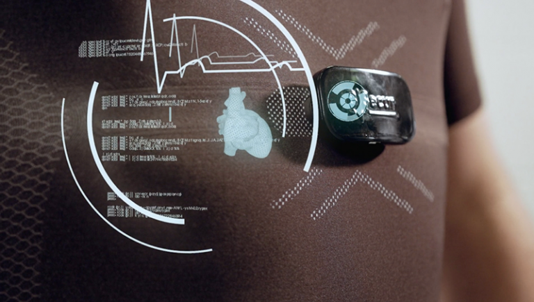 B Secur EKG wellness