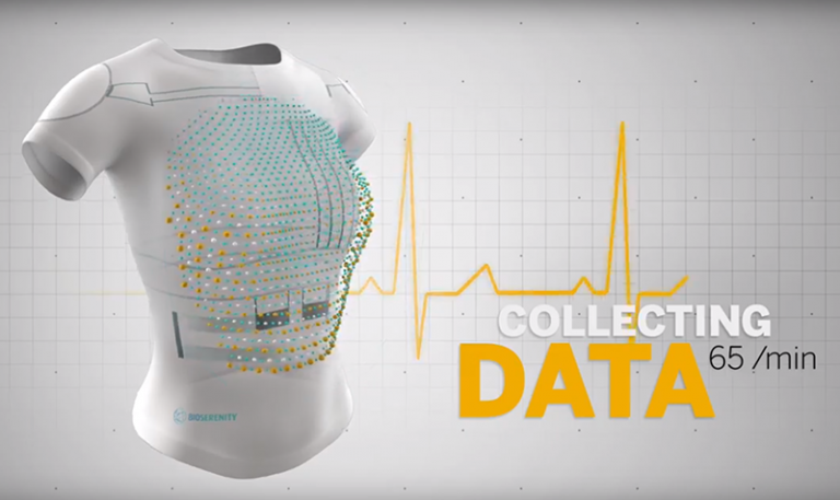 BioSerenity Epilepsy diagnosis