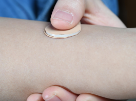 Rapidly Separable Microneedle Patch Allows Women to Administer Birth Control Themselves Microneedle patch for contraception