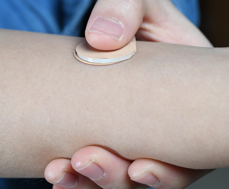 Microneedle patch for contraception