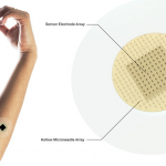 How Microneedle Systems Could Provide Safe, Effective and Painless Drug Delivery Microneedle systems