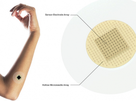 How Microneedle Systems Could Provide Safe, Effective and Painless Drug Delivery Microneedle systems