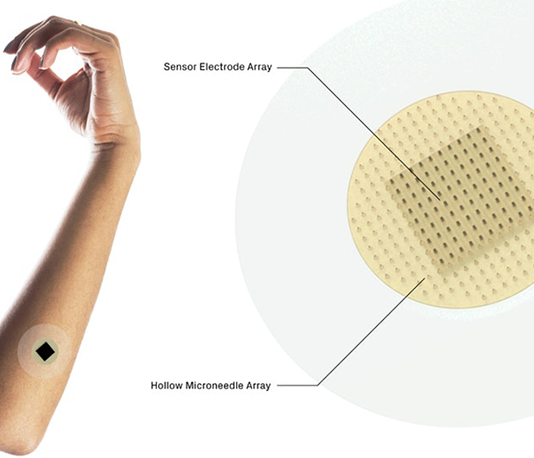 How Microneedle Systems Could Provide Safe, Effective and Painless Drug Delivery Microneedle systems